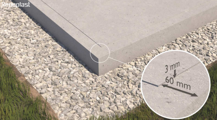 System Renodrain XL Renoplast