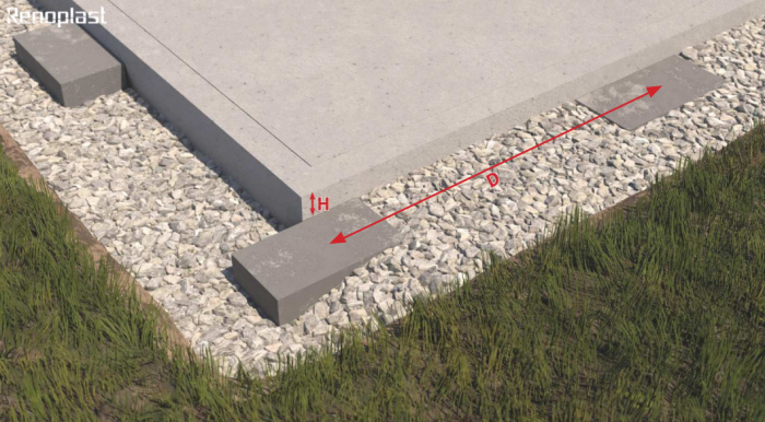 System Renodrain XL Renoplast
